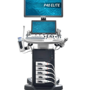 SonoScape P40 Elite